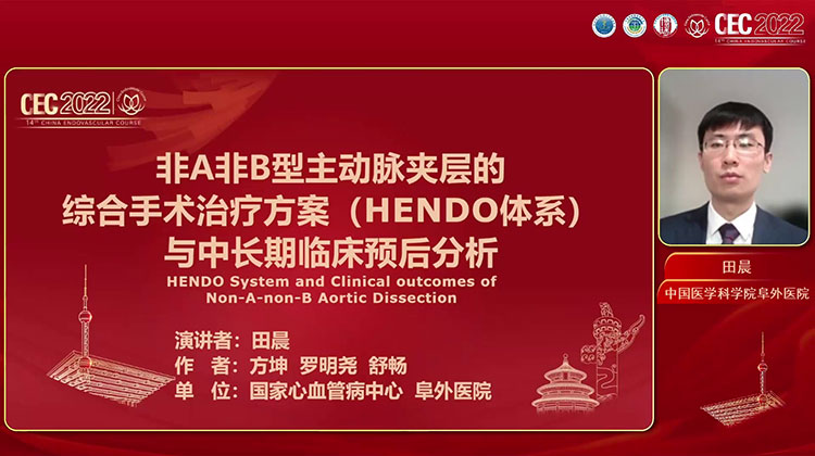 非A非B型主动脉夹层的综合手术治疗方案（HENDO）与中长期临床预后分析-田晨