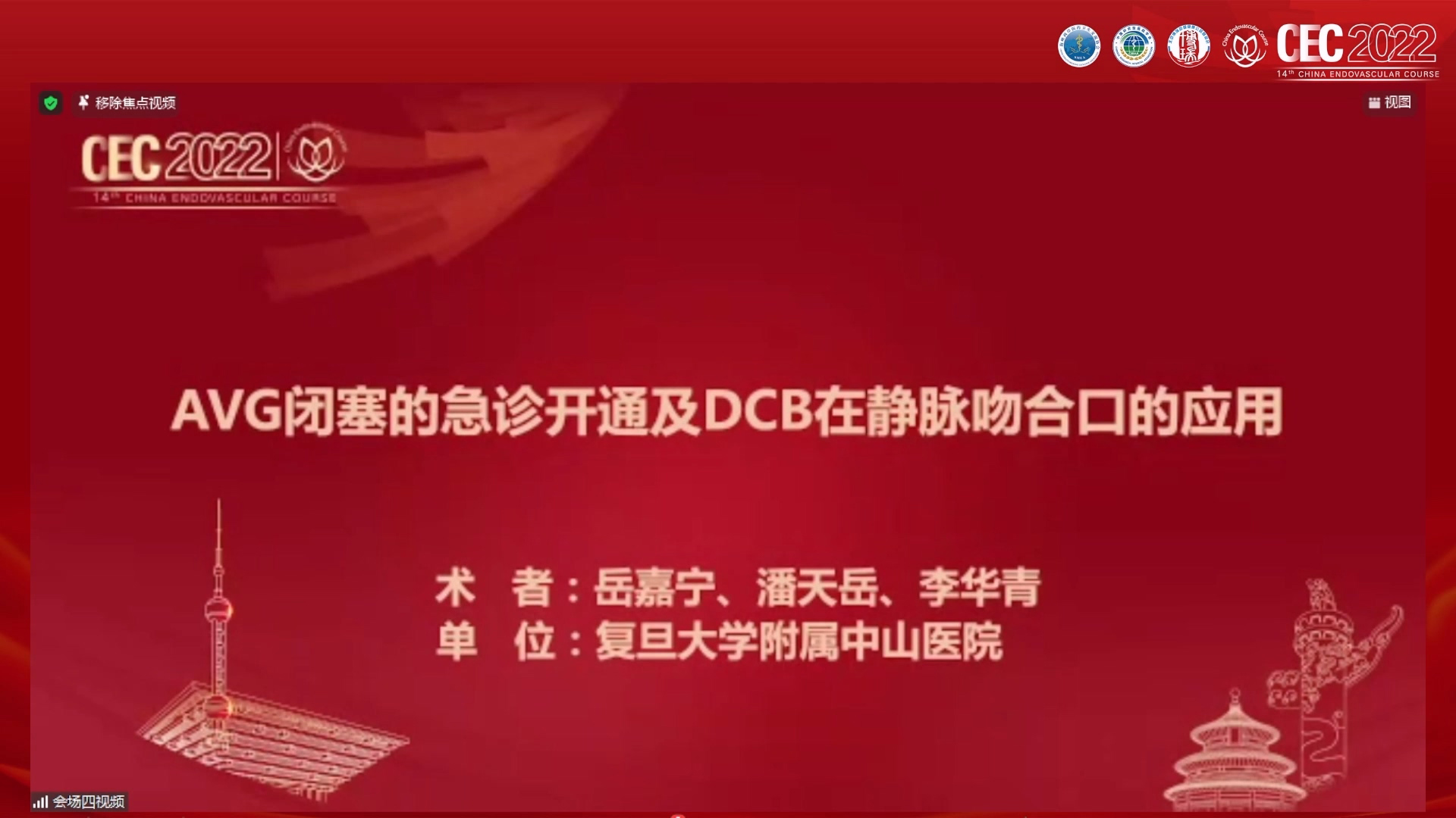 AVG闭塞的急诊开通及DCB在静脉吻合口的应用-岳嘉宁 潘天岳
