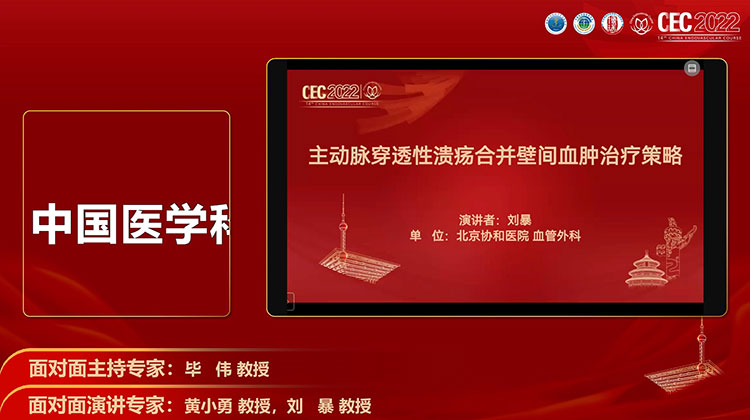 主动脉穿透性溃疡合并壁间血肿治疗策略-刘暴