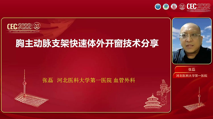 胸主动脉支架体外快速开窗技术三步法-张磊（河北）