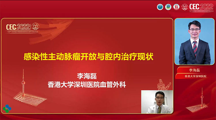 感染性主动脉瘤的开放与腔内治疗现状-李海磊