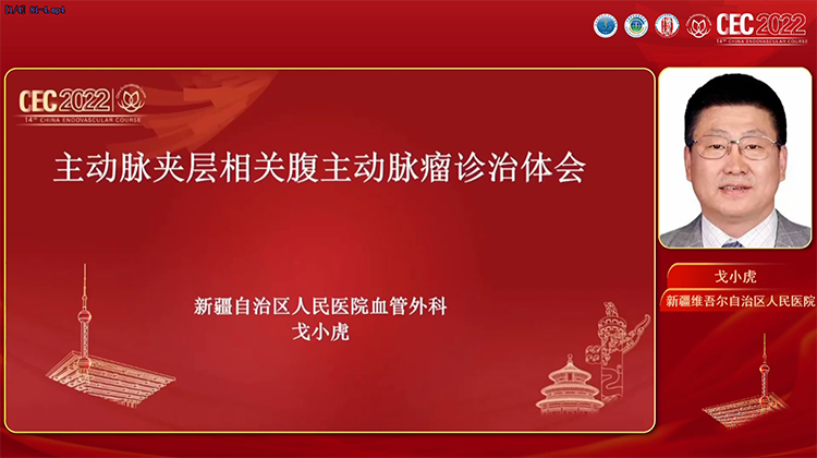 主动脉夹层相关腹主动脉瘤诊治体会-戈小虎
