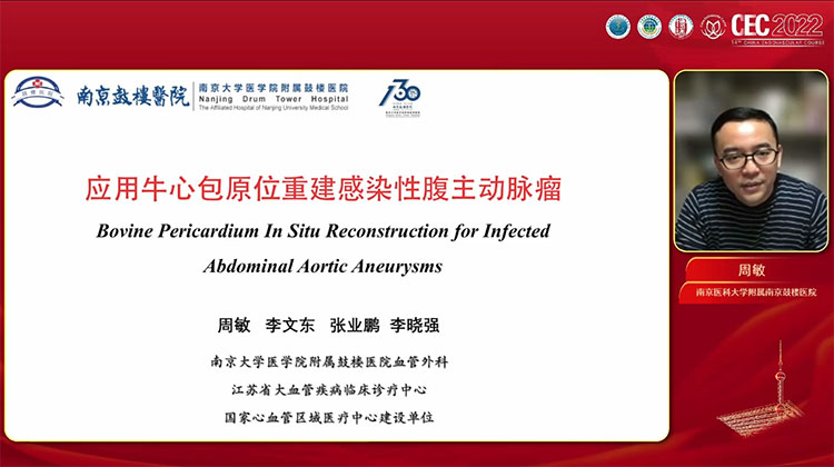 应用牛心包原位重建感染性腹主动脉瘤-周敏