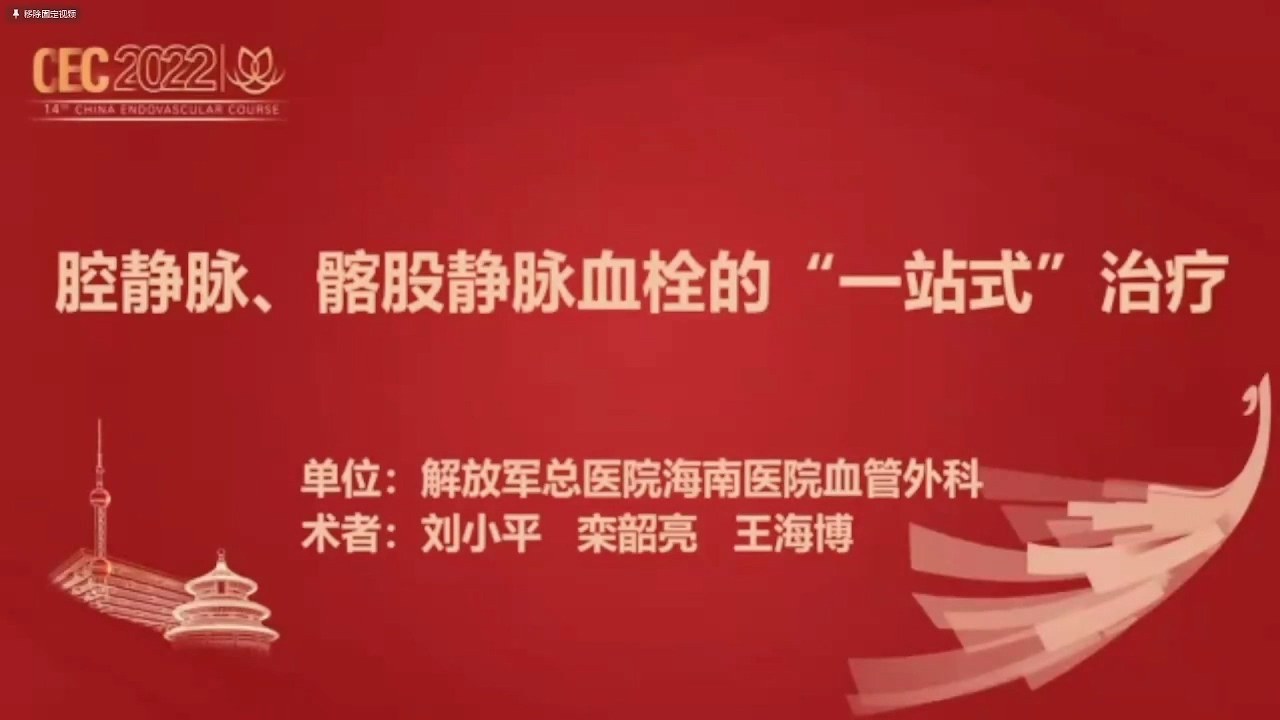 腔静脉、髂股静脉血栓的&ldquo;一站式&rdquo;治疗-刘小平 许永乐