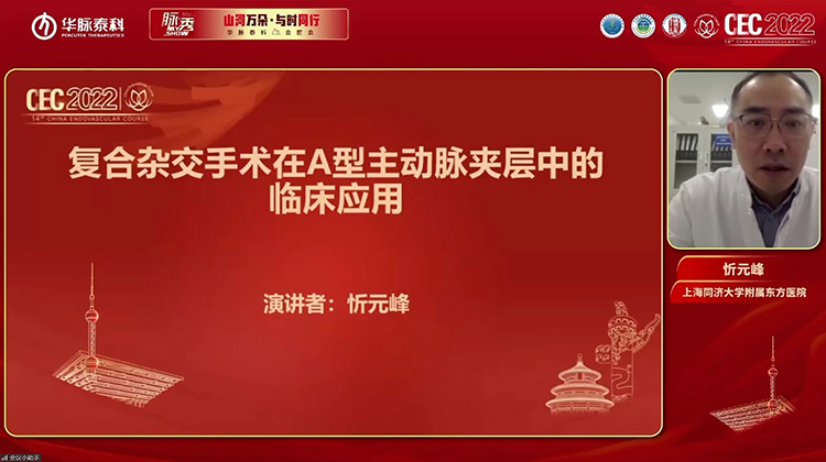 复合杂交手术在A型主动脉夹层中的临床应用-忻元峰