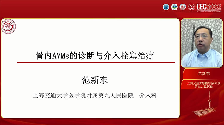 骨内AVMs的诊断和介入栓塞治疗-范新东