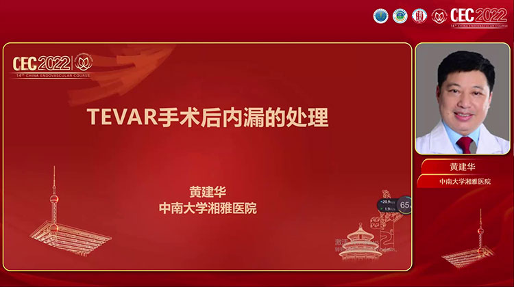 主动脉夹层腔内治疗术后内漏的处理-黄建华