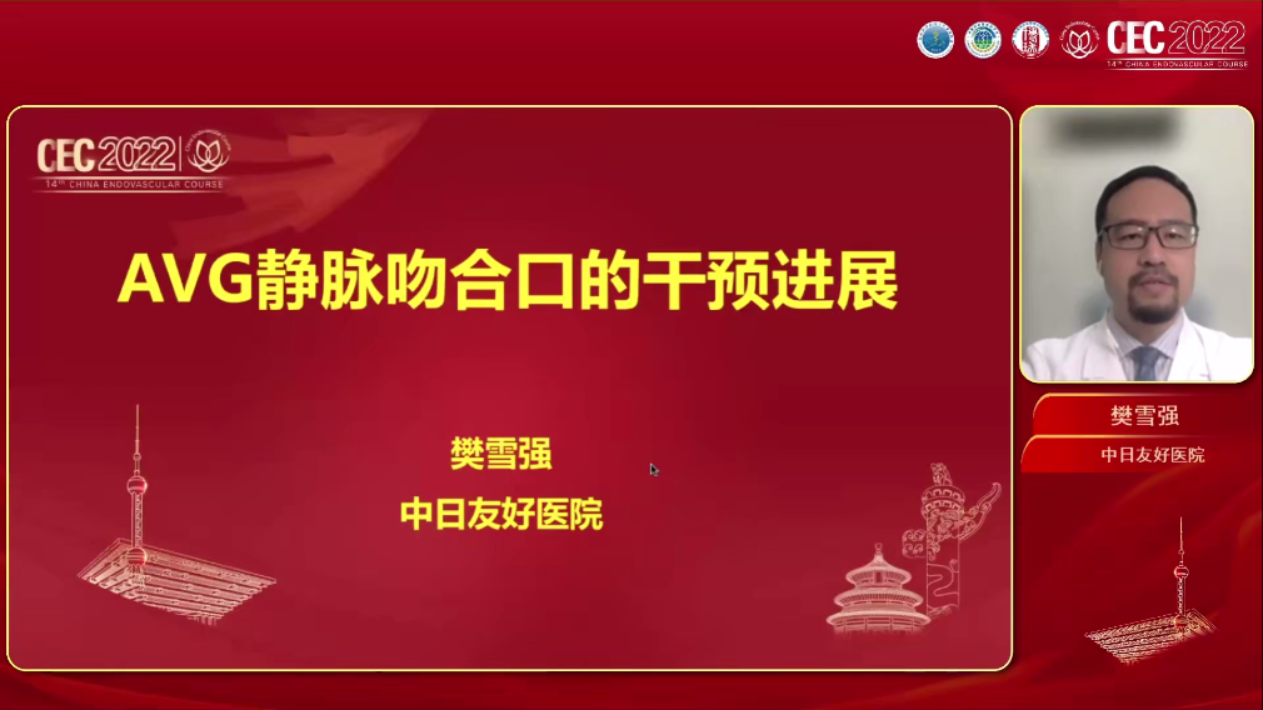 AVG静脉吻合口的干预进展-樊雪强
