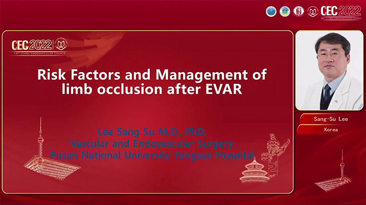 腹主动脉瘤腔内修复术（EVAR）后髂支闭塞的危险因素及治疗 Risk factor and Management of limb occlusion after EVAR-Sang-Su Lee
