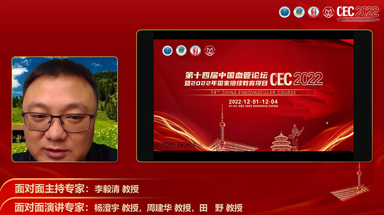 突发截瘫表现的Ⅲ型胸主夹层病例诊治反思-田野