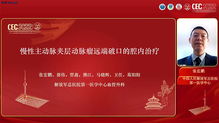 慢性主动脉夹层动脉瘤远端破口的腔内治疗-张宏鹏