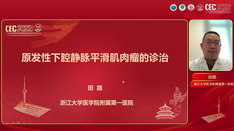 原发性下腔静脉平滑肌肉瘤的诊治-田路