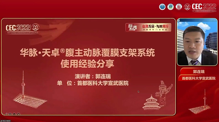 华脉&middot;天卓&reg;腹主动脉覆膜支架系统使用经验分享-郭连瑞