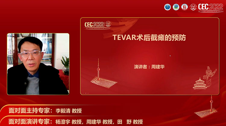 TEVAR术后截瘫的预防-周建华