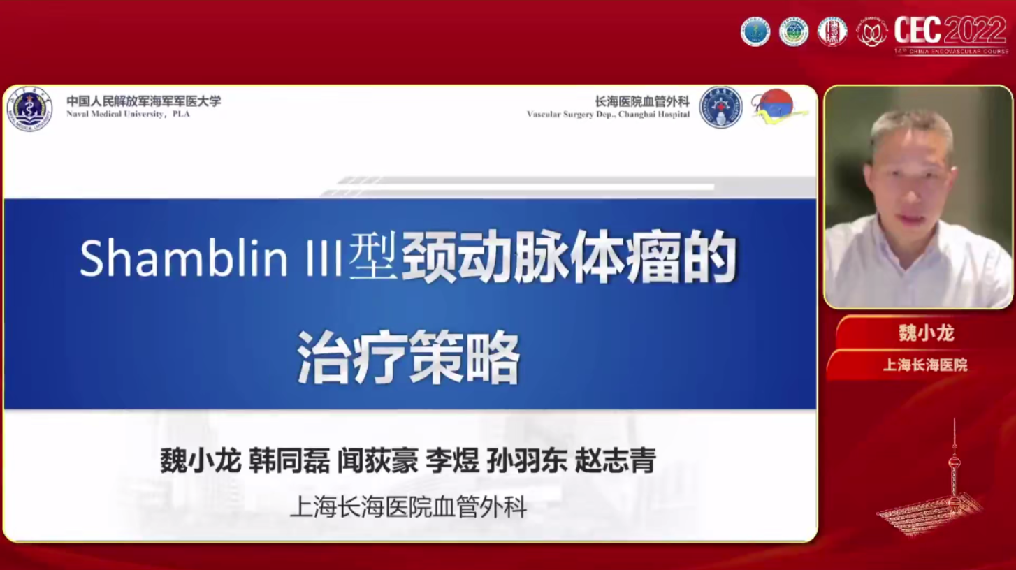 III型颈动脉体瘤的治疗策略-魏小龙