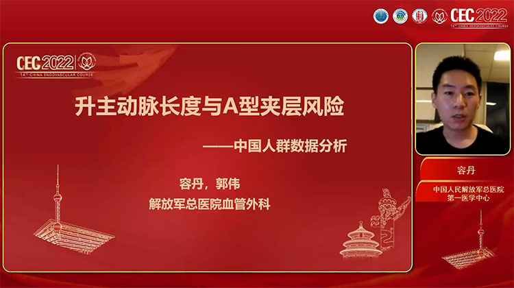 升主动脉长度和A型夹层的关系-容丹