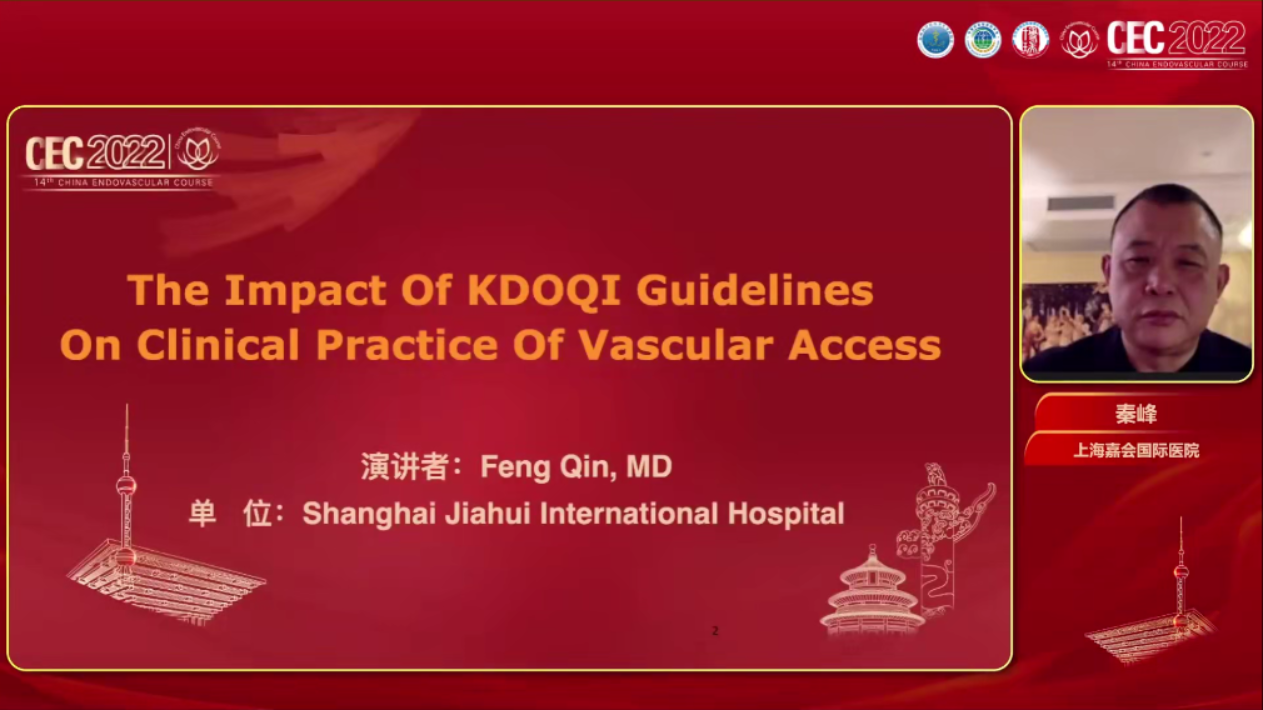 The impact of KDOQI guidelines on clinical practice of vascular access-秦峰