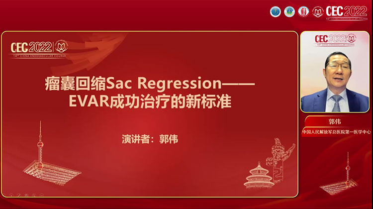Sac Regression 瘤囊回缩&mdash;&mdash;EVAR治疗的新标准-郭伟