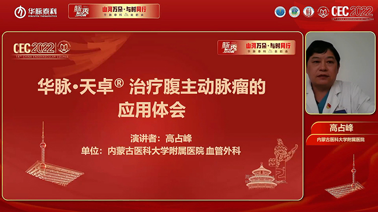 华脉&middot;天卓&reg;治疗腹主动脉瘤的应用体会-高占峰