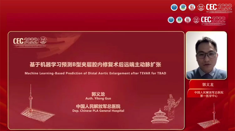 基于机器学习预测Stanford-B型夹层腔内修复术后远端主动脉扩张-郭义龙