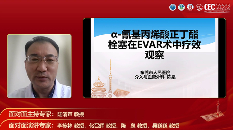 &alpha;-氰基丙烯酸正丁酯栓塞在EVAR术中疗效观察-陈泉.