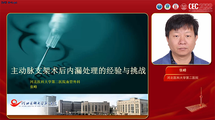 主动脉支架术后内漏处理的经验与挑战 张峰