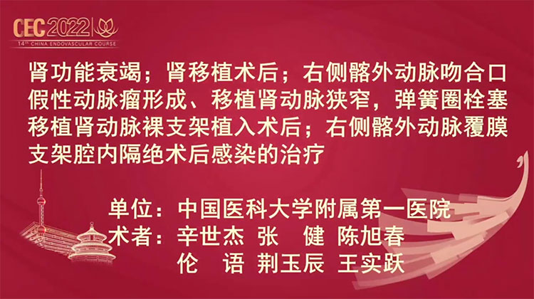 肾移植术后感染性髂外动脉瘤的手术治疗-辛世杰