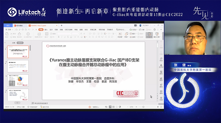 Yuranos腹主动脉覆膜支架联合G-iliac国产IBD支架在腹主动脉瘤合并髂总动脉瘤中的应用-张健