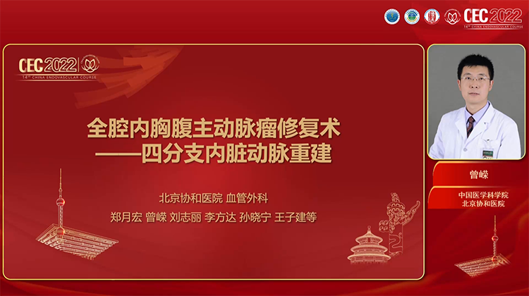 全腔内胸腹主动脉瘤修复术-四分支内脏动脉重建-曾嵘