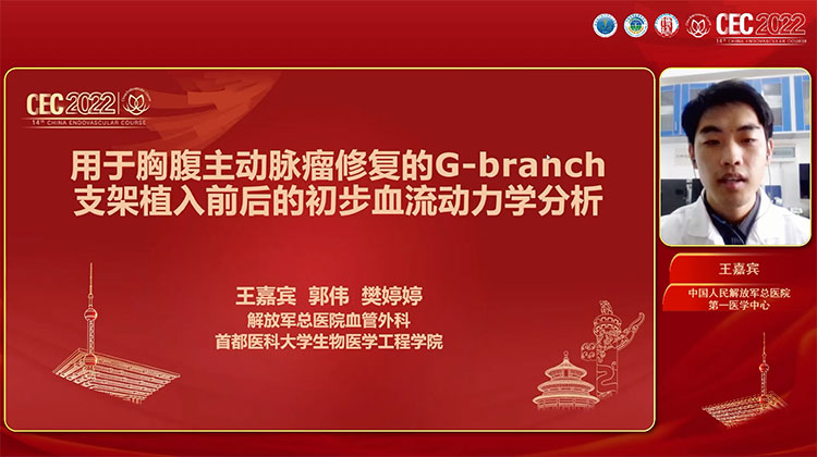 用于胸腹主动脉瘤修复的G-branch支架植入前后的初步血流动力学分析-王嘉宾