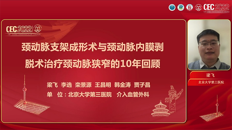 颈动脉支架成形术与颈动脉内膜剥脱术治疗颈动脉狭窄的10年回顾-梁飞