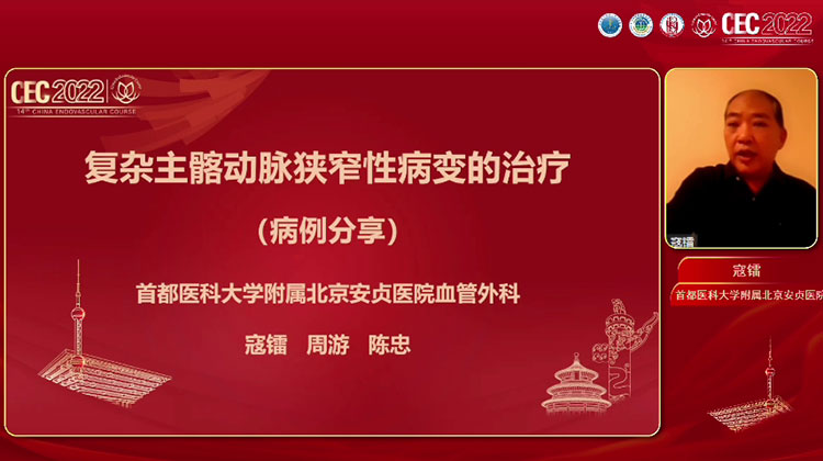 复杂主髂动脉狭窄性病变的治疗（病例分享）-寇镭