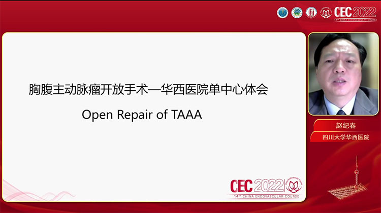 胸腹主动脉瘤的开放手术-华西医院单中心体会-赵纪春