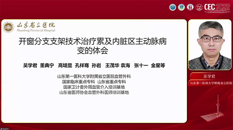 多开窗分支支架技术治疗内脏区主动脉瘤经验分享-吴学君