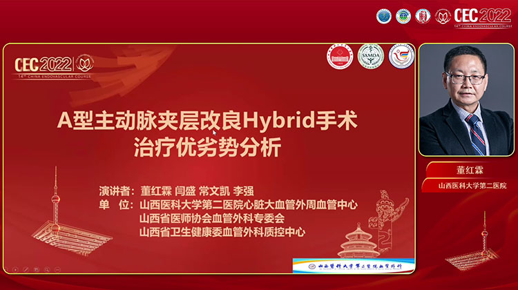 A型夹层杂交手术优劣势分析-董红霖