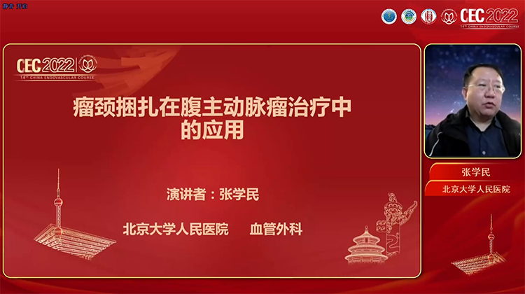 瘤颈捆扎在腹主动脉瘤治疗中的应用-张学民