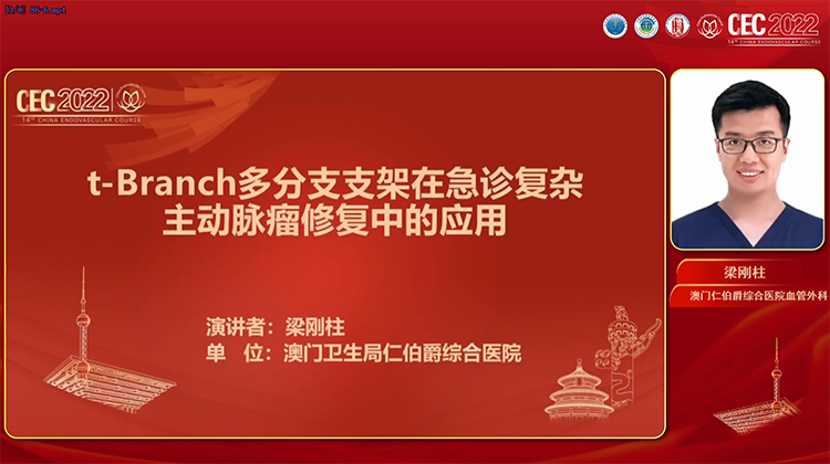 t-branch多分支支架在急诊复杂主动脉瘤修复中的应用-梁刚柱