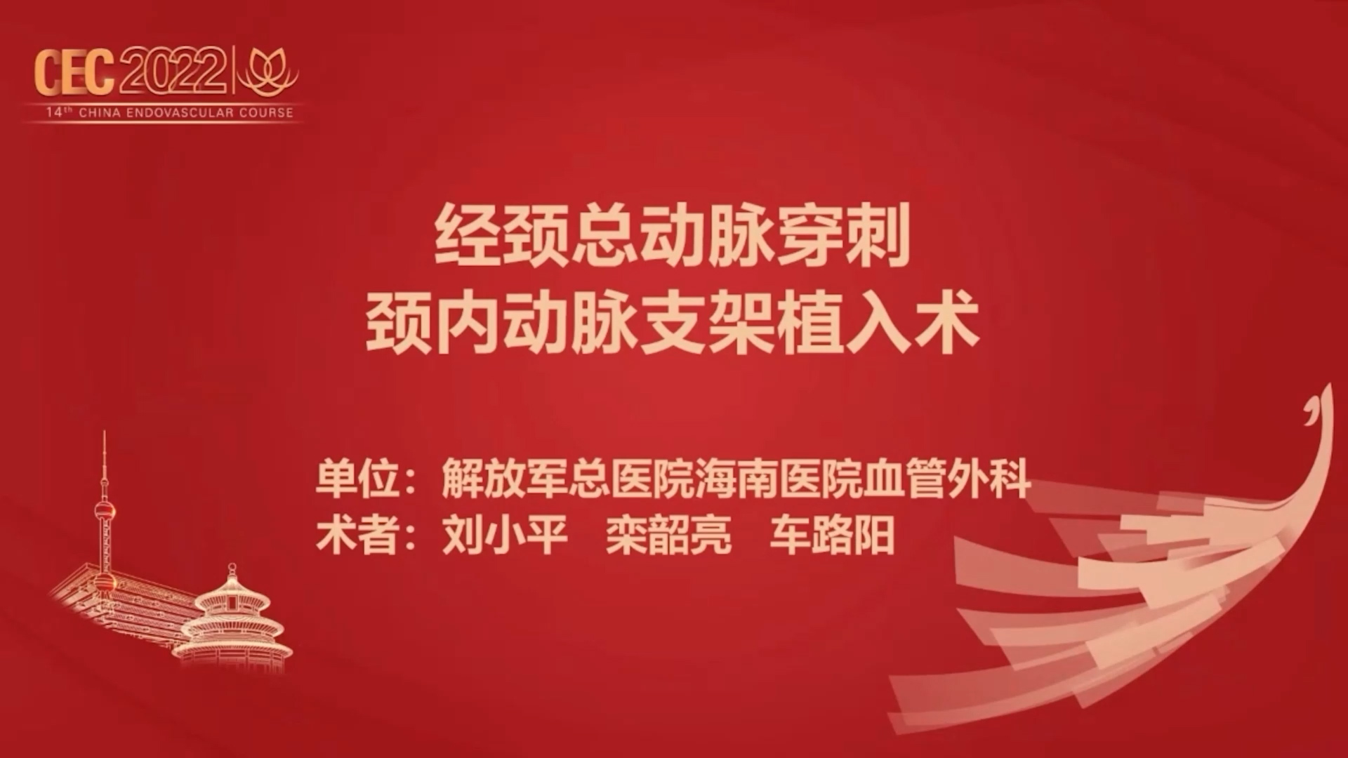 经颈总动脉穿刺颈内动脉支架植入术-刘小平 栾韶亮