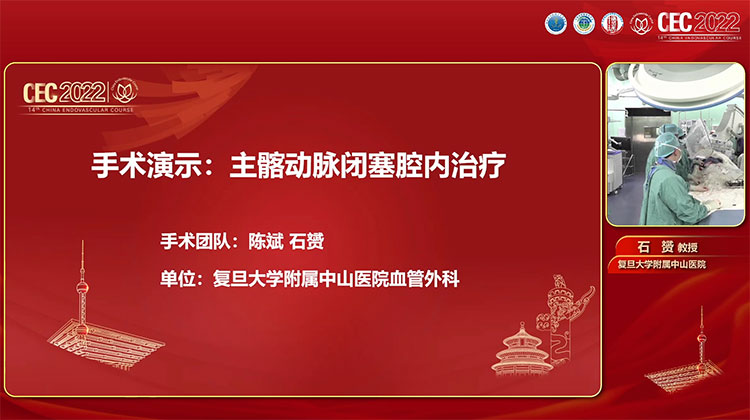 手术演示：主髂动脉闭塞腔内治疗-陈斌，石赟 