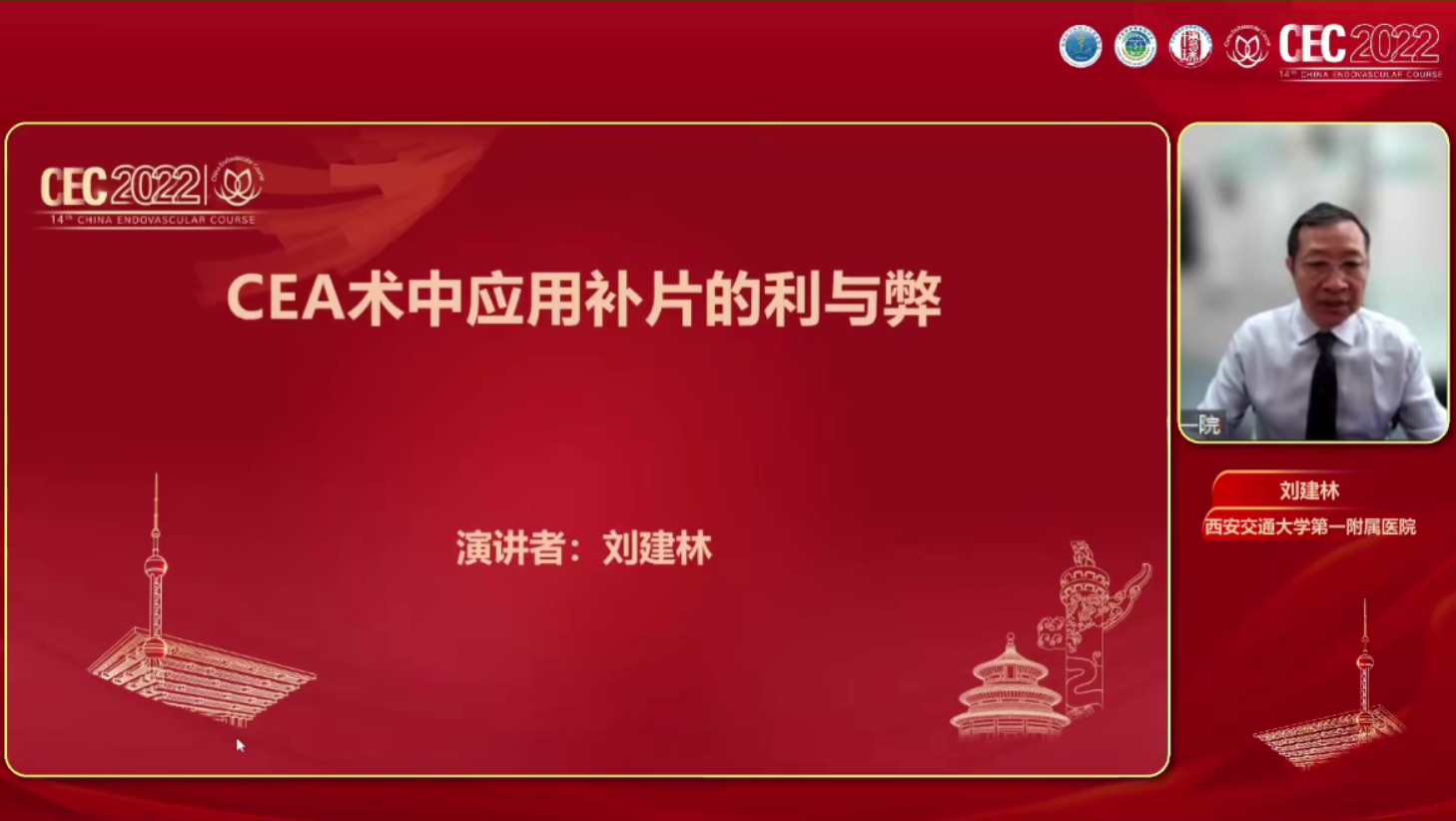 CEA术中应用补片的利与弊-刘建林