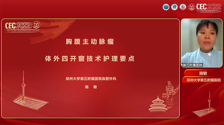 胸腹主动脉瘤四开窗技术护理要点-施敏