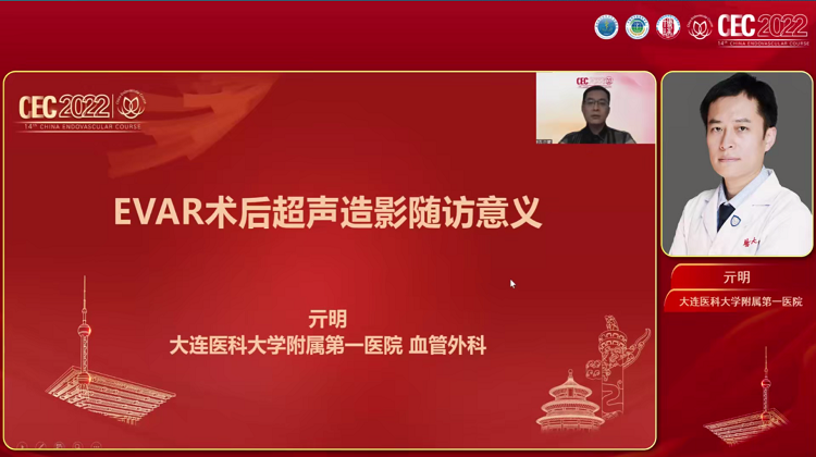 EVAR术后超声造影随访的意义-亓明