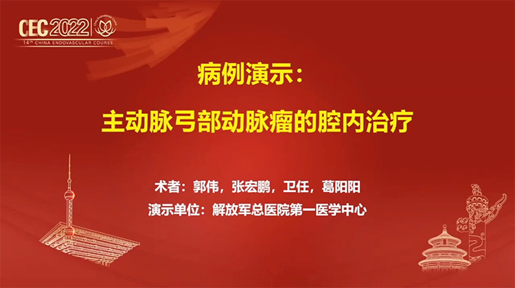 主动脉弓部动脉瘤的腔内治疗-郭伟 张宏鹏