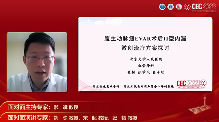 腹主动脉瘤EVAR术后II型内漏微创治疗方案探讨-张韬