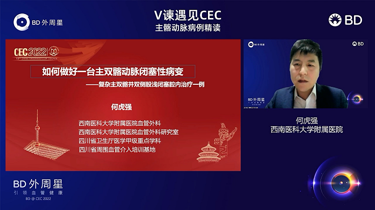 复杂主髂动脉病变病例一例-何虎强