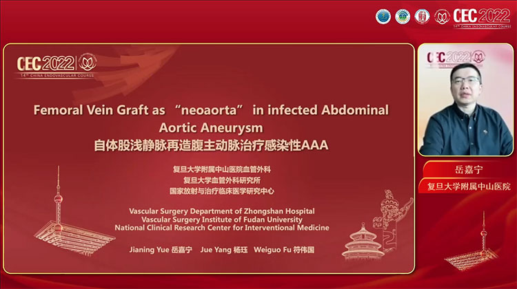 自体股浅静脉再造腹主动脉治疗感染性腹主动脉瘤-岳嘉宁