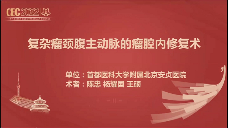 复杂瘤颈腹主动脉的瘤腔内修复术-陈忠 杨耀国 