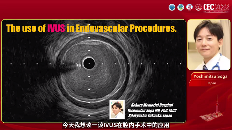 腔内手术中血管内超声（IVUS）的使用 The use of IVUS in Endovascular Procedures-Yoshimitsu Soga