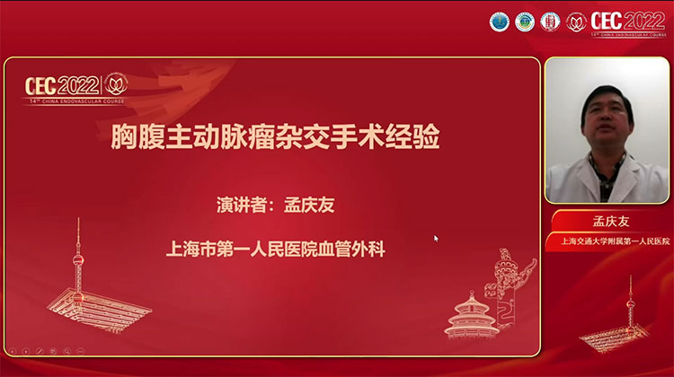 胸腹主动脉瘤杂交手术经验-孟庆友
