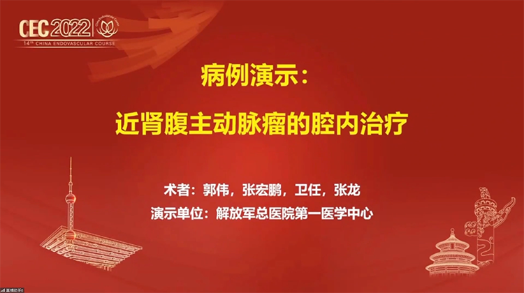 病理演示：近肾腹主动脉瘤的腔内治疗-郭伟 张宏鹏
